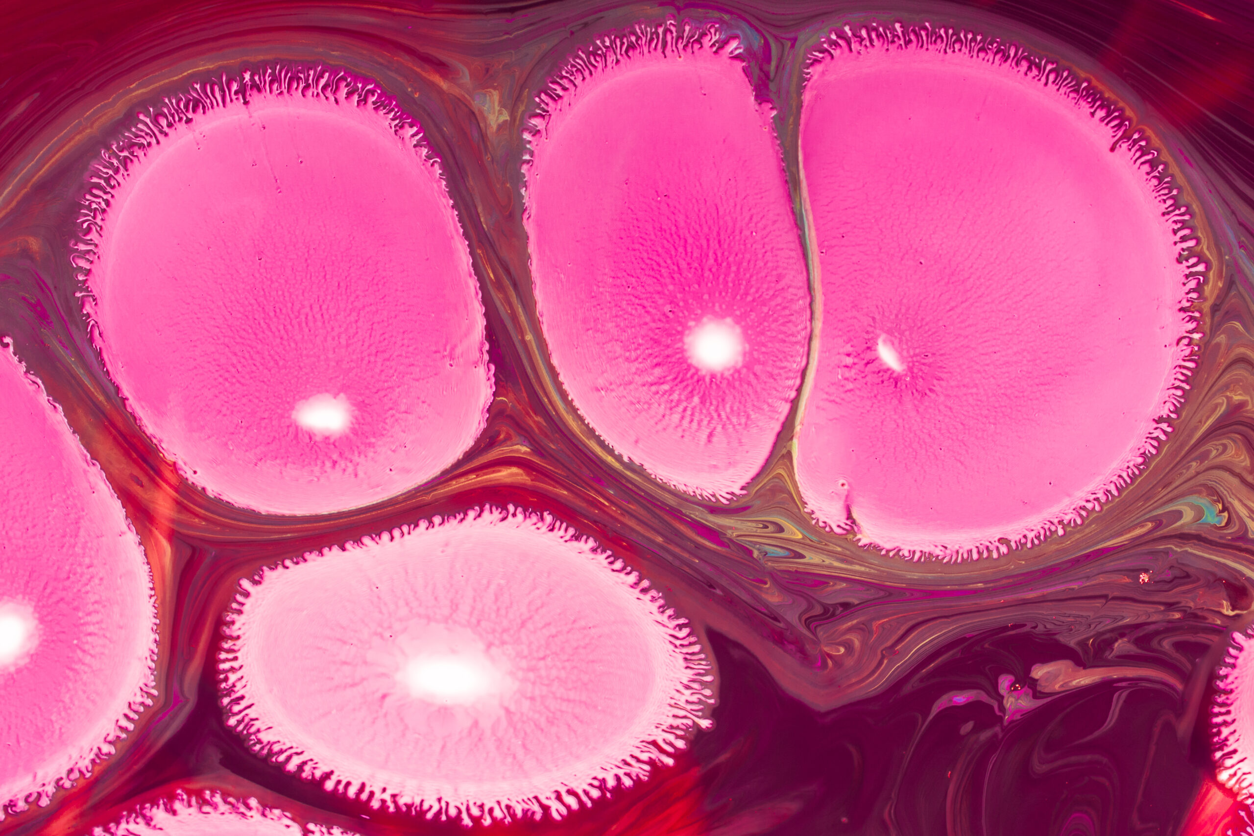 Managing Gut Autoimmunity: Advanced Microbiome Strategies for Inflammatory Bowel Disease