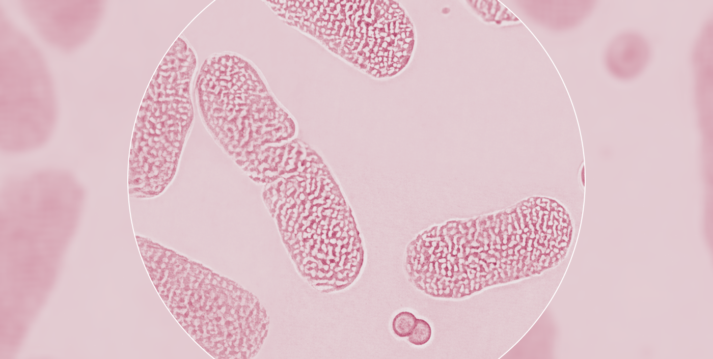 Overview:  Measuring the microbiome as an ecosystem